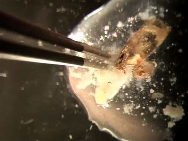Dissection and Mounting of <em>Drosophila</em> Pupal Eye Discs