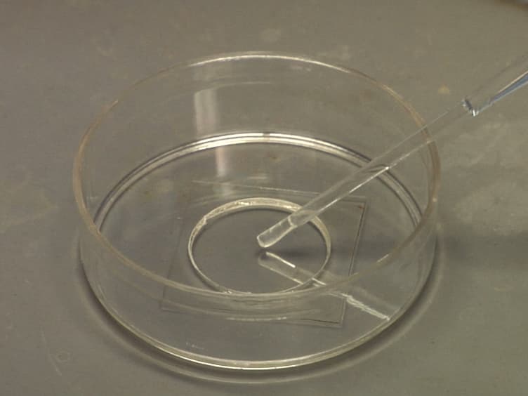 Polyacrylamide Gels for Invadopodia and Traction Force Assays on Cancer Cells