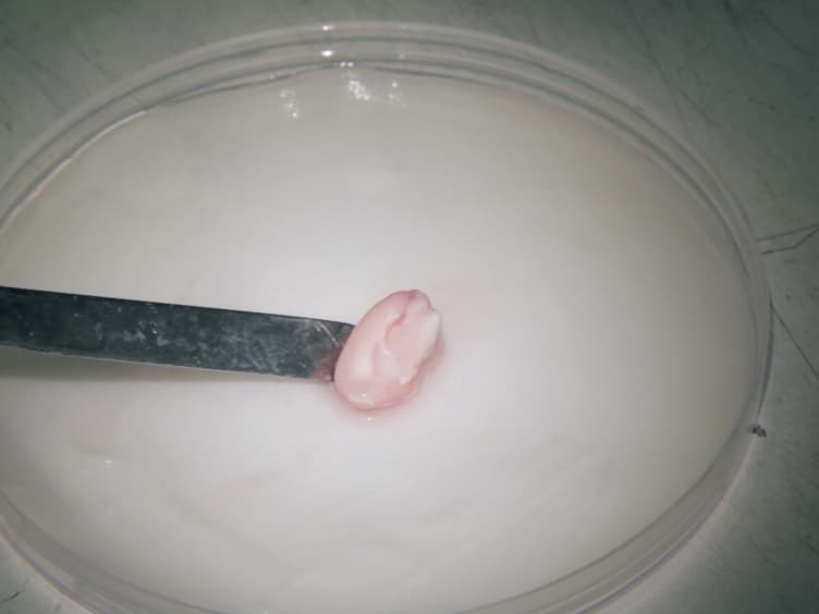 Organotypic Slice Cultures for Studies of Postnatal Neurogenesis