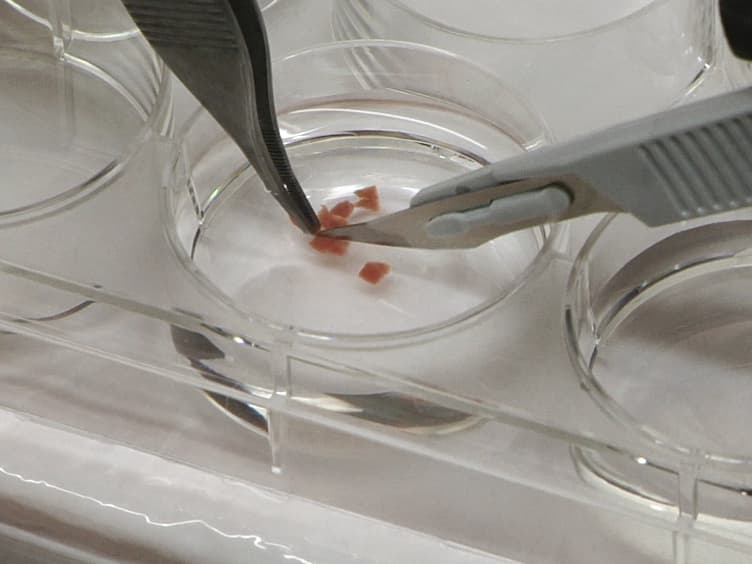 Isolation of Primary Human Colon Tumor Cells from Surgical Tissues and Culturing Them Directly on Soft Elastic Substrates for Traction Cytometry