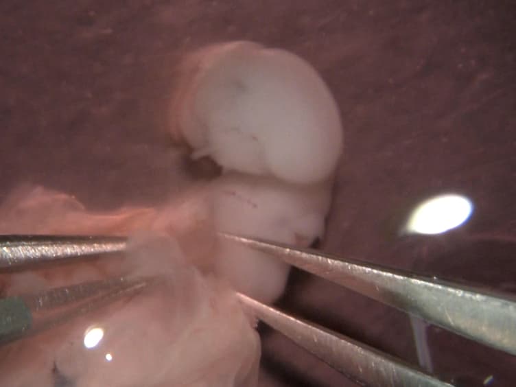 <em>Ex Utero</em> Electroporation and Organotypic Slice Culture of Mouse Hippocampal Tissue