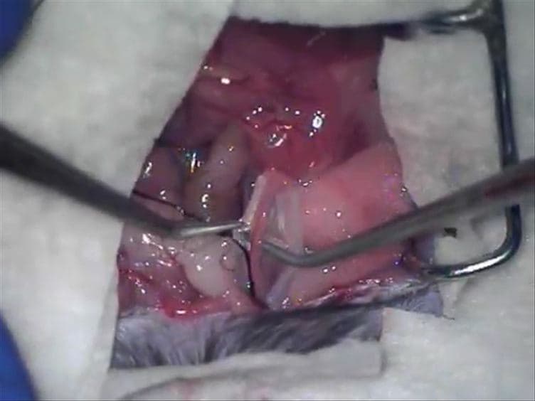 A Murine Model of Irreversible and Reversible Unilateral Ureteric Obstruction