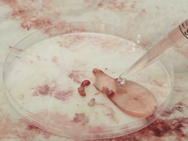 Lymphocyte Isolation from Human Skin for Phenotypic Analysis and <em>Ex Vivo</em> Cell Culture