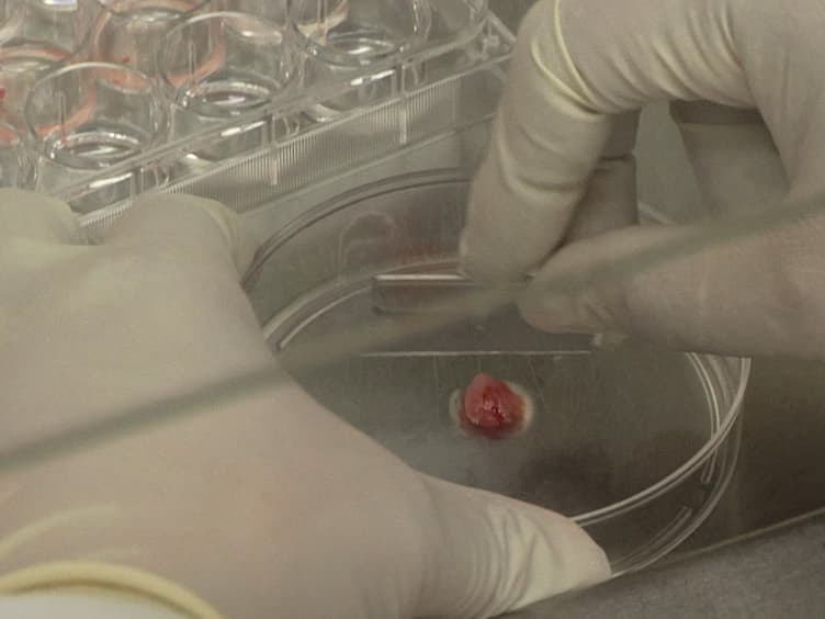 Primary Tumor and MEF Cell Isolation to Study Lung Metastasis