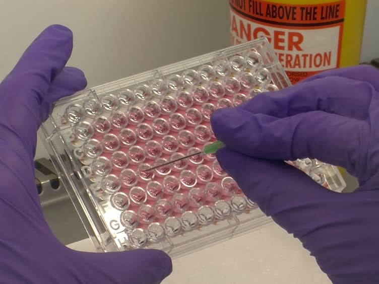 Three-Dimensional (3D) Tumor Spheroid Invasion Assay