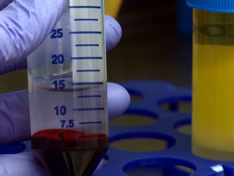 Simplified Human Neutrophil Extracellular Traps NETs Isolation and Handling