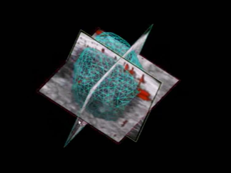 High-frequency Ultrasound Imaging of Mouse Cervical Lymph Nodes