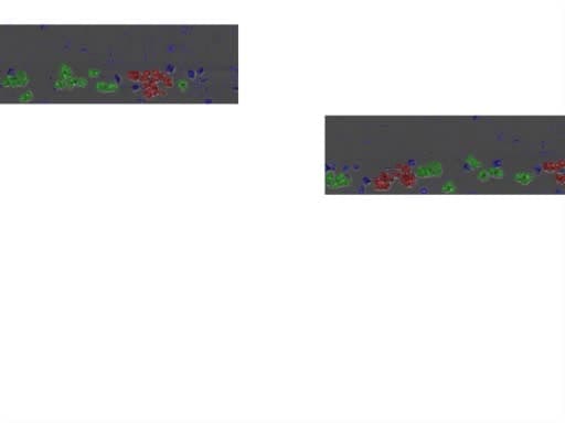 Controlled Microfluidic Environment for Dynamic Investigation of Red Blood Cell Aggregation