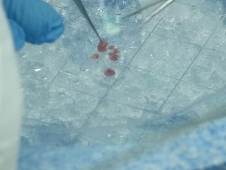Isolation and Cryopreservation of Neonatal Rat Cardiomyocytes