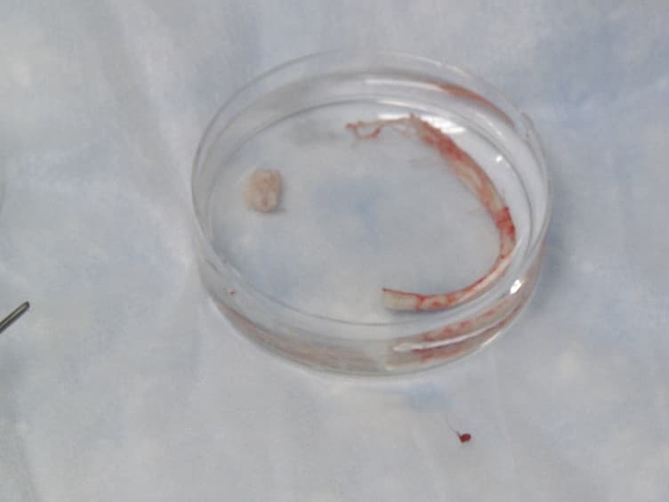 Isolation of Neural Stem/Progenitor Cells from the Periventricular Region of the Adult Rat and Human Spinal Cord