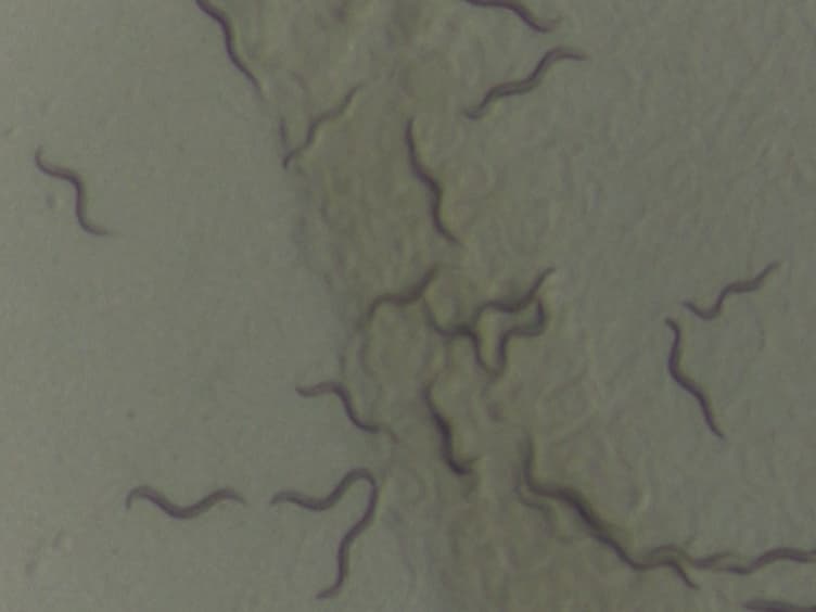 Measuring Oxidative Stress Resistance of <em>Caenorhabditis elegans</em> in 96-well Microtiter Plates