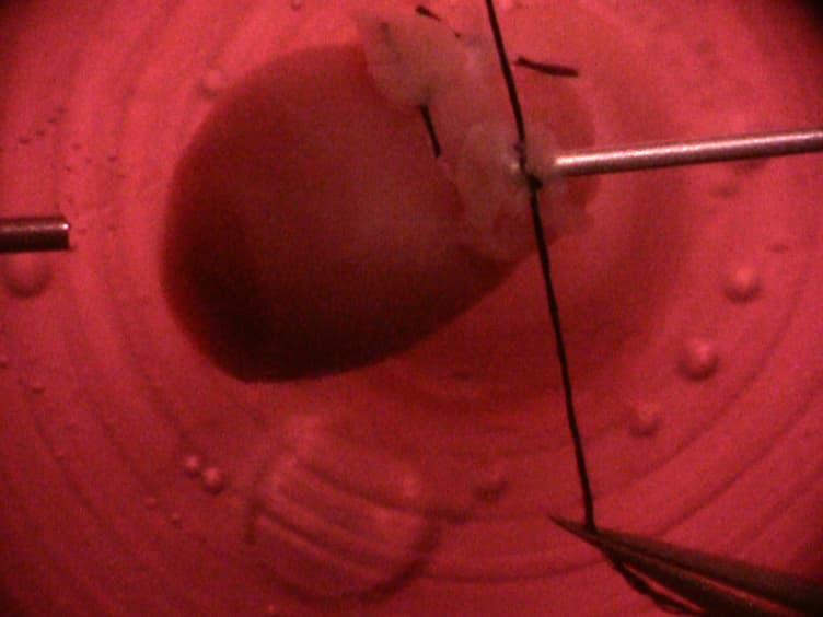 Culturing Mouse Cardiac Valves in the Miniature Tissue Culture System