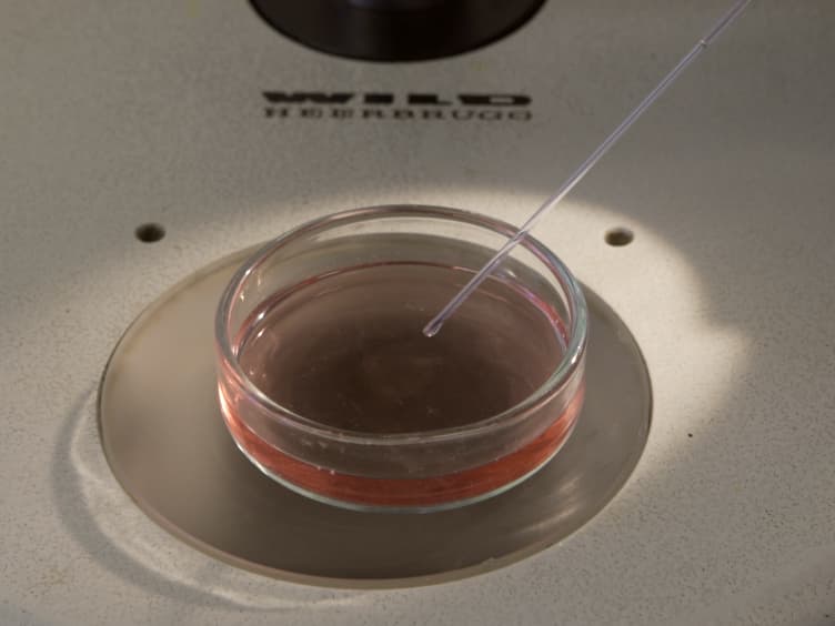 Chick Heart Invasion Assay for Testing the Invasiveness of Cancer Cells and the Activity of Potentially Anti-invasive Compounds