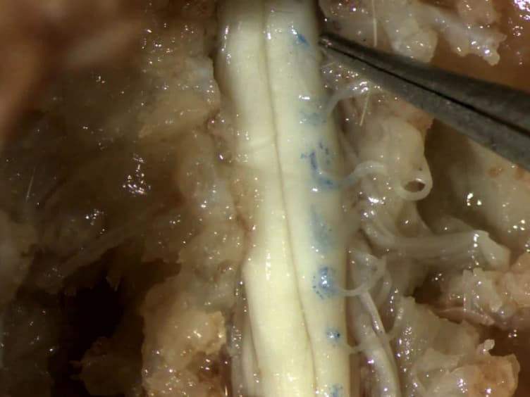 Intramuscular Injections Along the Motor End Plates: A Minimally Invasive Approach to Shuttle Tracers Directly into Motor Neurons
