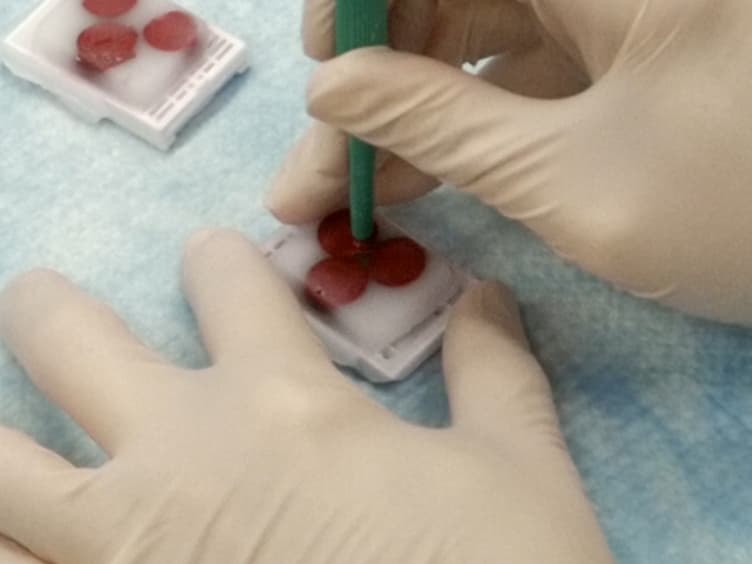 SpOT the Correct Tissue Every Time in Multi-tissue Blocks