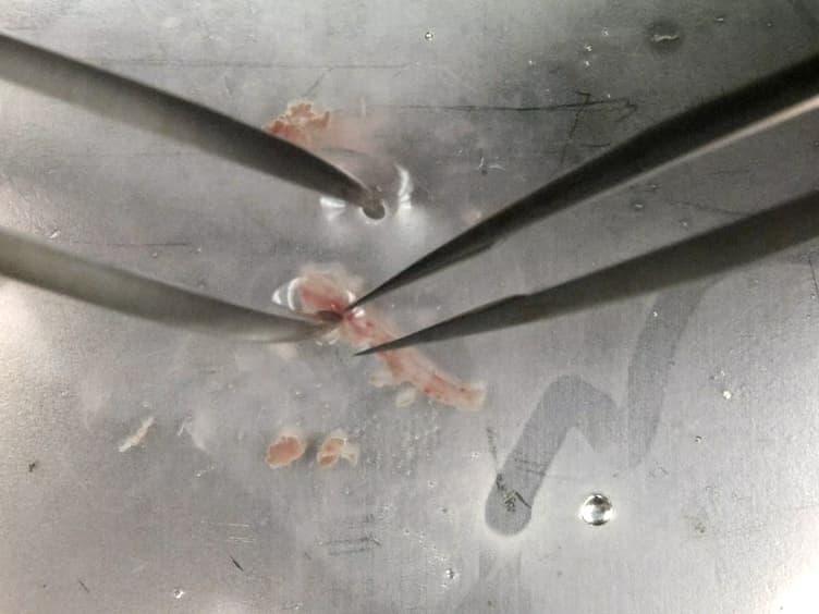Isolation and Primary Culture of Mouse Aortic Endothelial Cells
