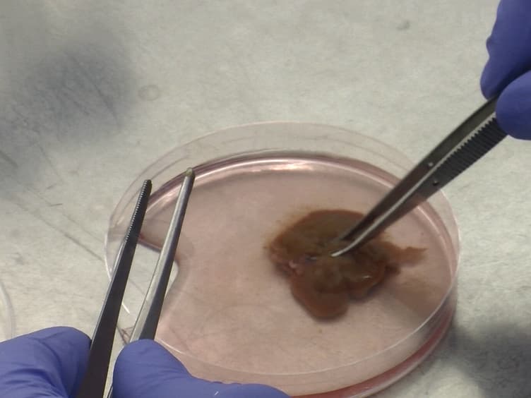 Kupffer Cell Isolation for Nanoparticle Toxicity Testing