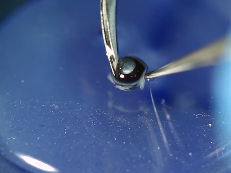 Limbal Approach-Subretinal Injection of Viral Vectors for Gene Therapy in Mice Retinal Pigment Epithelium
