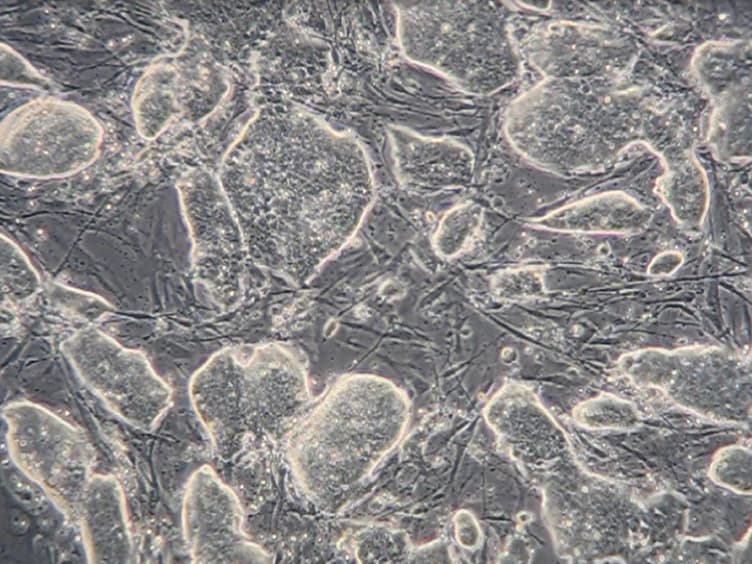 Forward Genetic Approach to Uncover Stress Resistance Genes in Mice — A High-throughput Screen in ES Cells