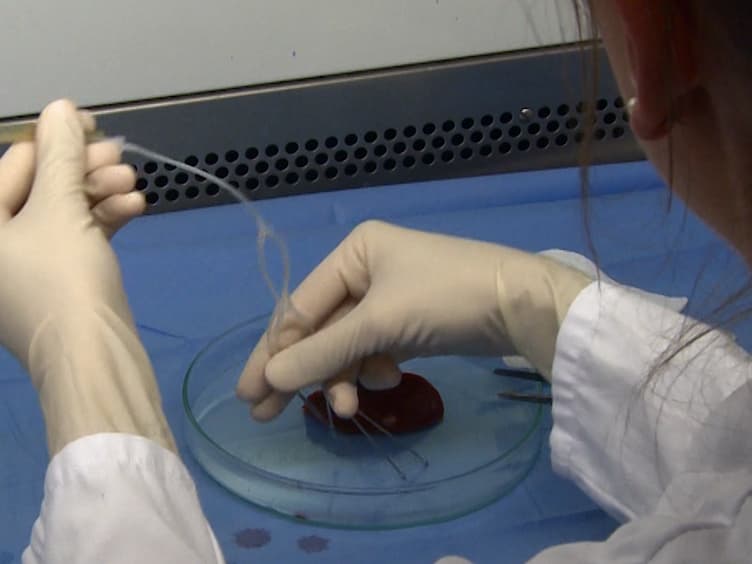 Protocol for Isolation of Primary Human Hepatocytes and Corresponding Major Populations of Non-parenchymal Liver Cells