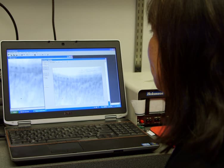 A Reproducible Computerized Method for Quantitation of Capillary Density using Nailfold Capillaroscopy