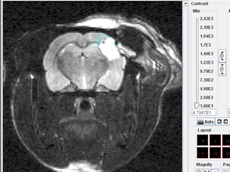 Performing Permanent Distal Middle Cerebral with Common Carotid Artery Occlusion in Aged Rats to Study Cortical Ischemia with Sustained Disability