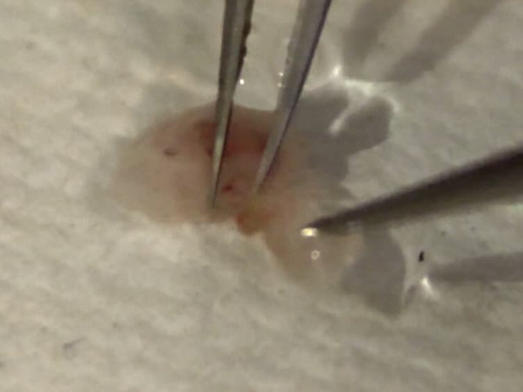 Using <em>Ex Vivo</em> Upright Droplet Cultures of Whole Fetal Organs to Study Developmental Processes during Mouse Organogenesis