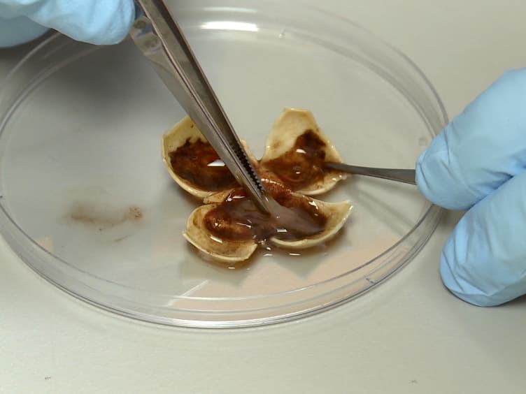 Enrichment of Bruch's Membrane from Human Donor Eyes