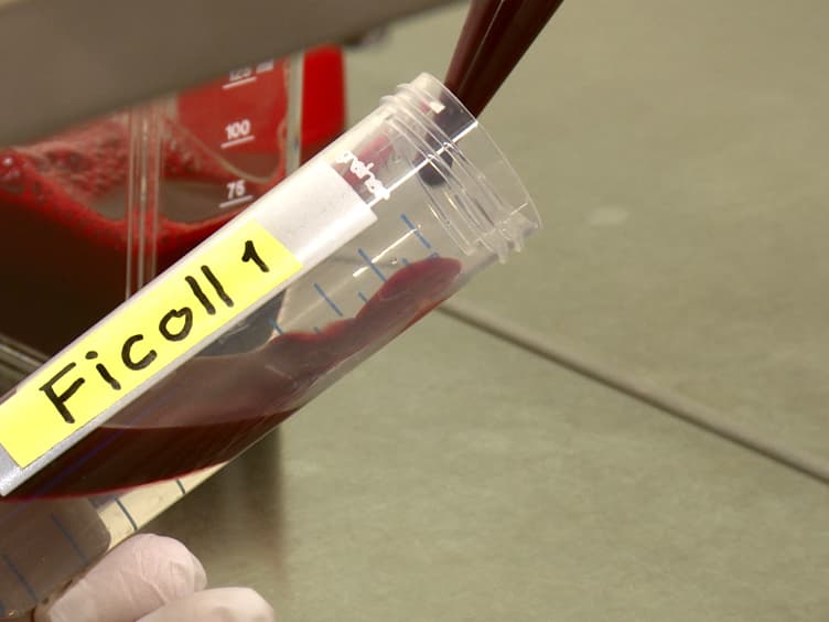 Isolation and <em>Ex Vivo</em> Culture of Vδ1<sup>+</sup>CD4<sup>+</sup>γδ T Cells, an Extrathymic αβT-cell Progenitor