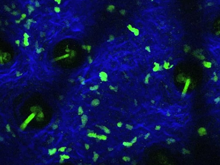 Imaging CD4 T Cell Interstitial Migration in the Inflamed Dermis