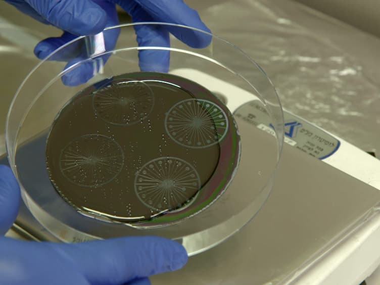 A Microfluidic Model of Biomimetically Breathing Pulmonary Acinar Airways