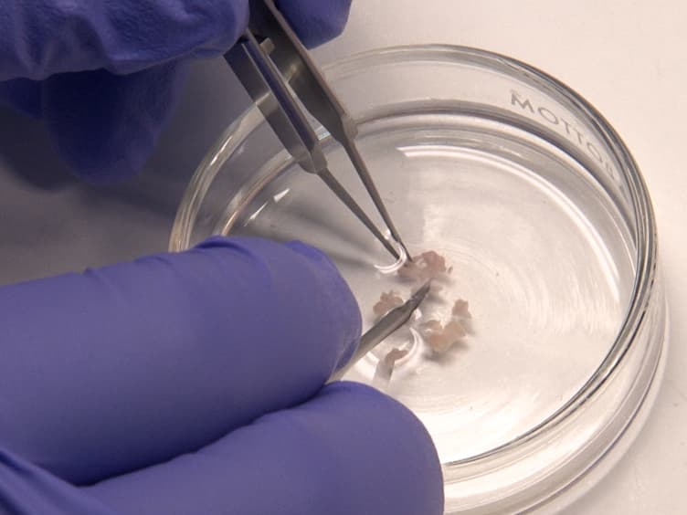 Three-dimensional Alginate-bead Culture of Human Pituitary Adenoma Cells