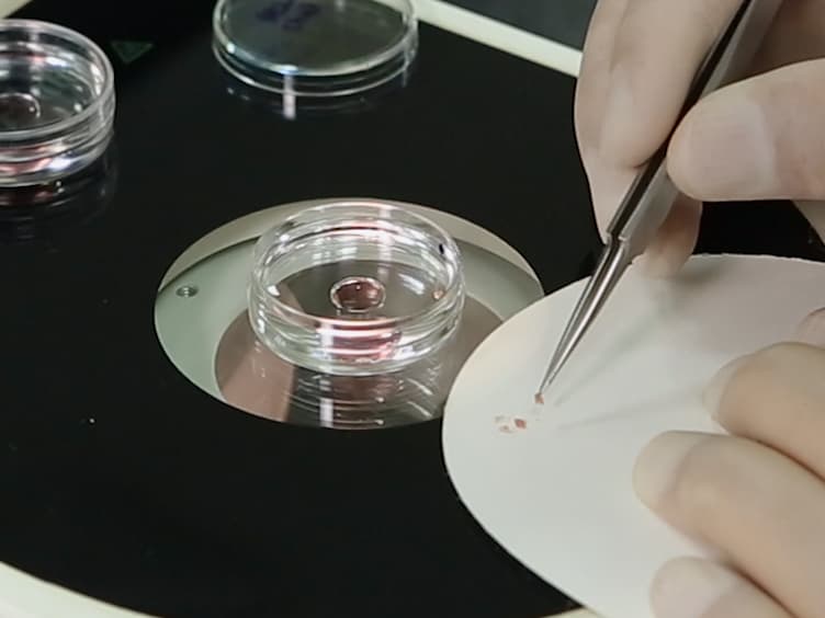 Loss- and Gain-of-function Approach to Investigate Early Cell Fate Determinants in Preimplantation Mouse Embryos