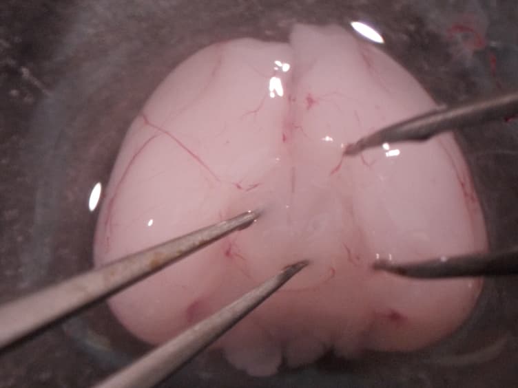 Preparation of Rat Oligodendrocyte Progenitor Cultures and Quantification of Oligodendrogenesis Using Dual-infrared Fluorescence Scanning