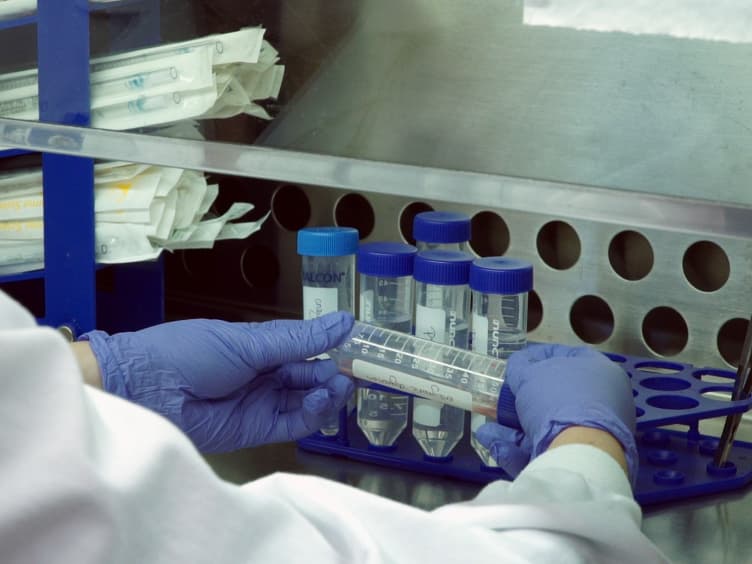 Isolation of CD146<sup>+</sup> Resident Lung Mesenchymal Stromal Cells from Rat Lungs