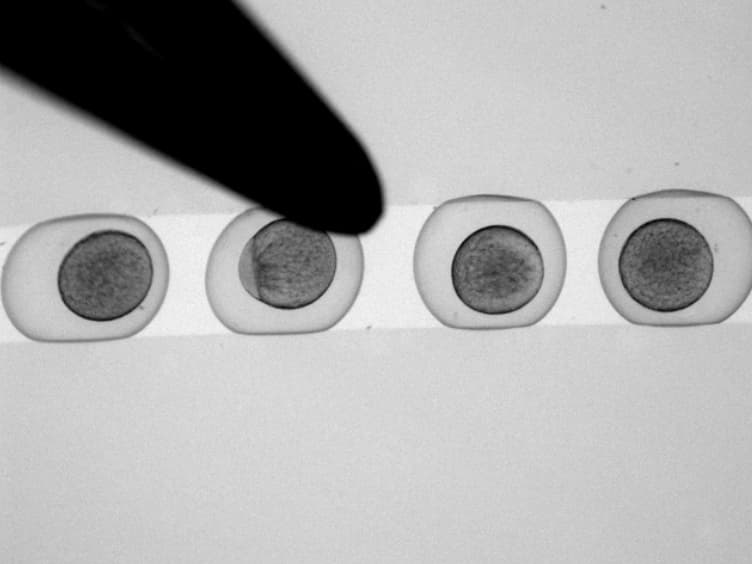 Analyzing In Vivo Cell Migration using Cell Transplantations and Time-lapse Imaging in Zebrafish Embryos