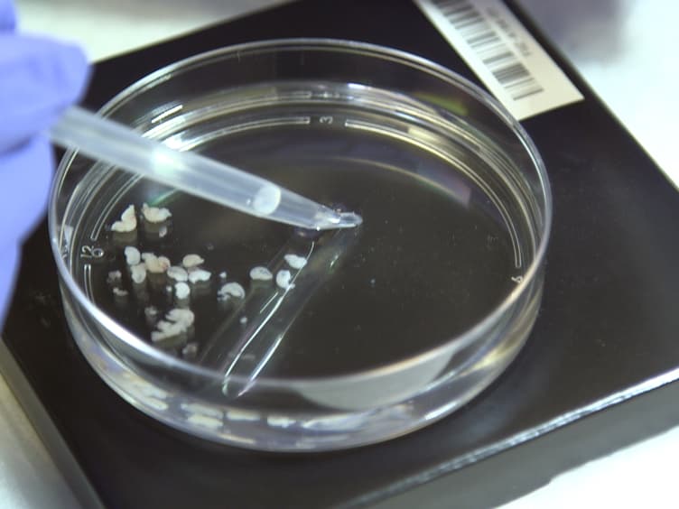 A Simplified Method for Ultra-Low Density, Long-Term Primary Hippocampal Neuron Culture