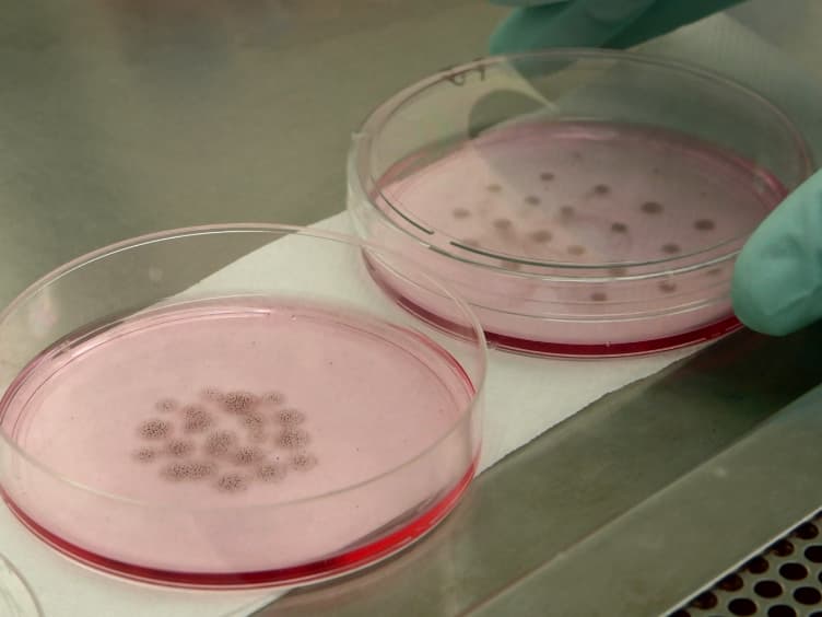 Feeder-free Derivation of Melanocytes from Human Pluripotent Stem Cells