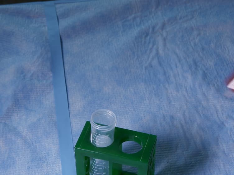 Selective Harvesting of Marginating-pulmonary Leukocytes