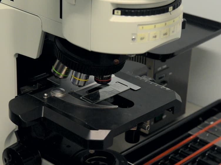 Clinicopathological Analysis of miRNA Expression in Breast Cancer Tissues by Using miRNA <em>In Situ</em> Hybridization