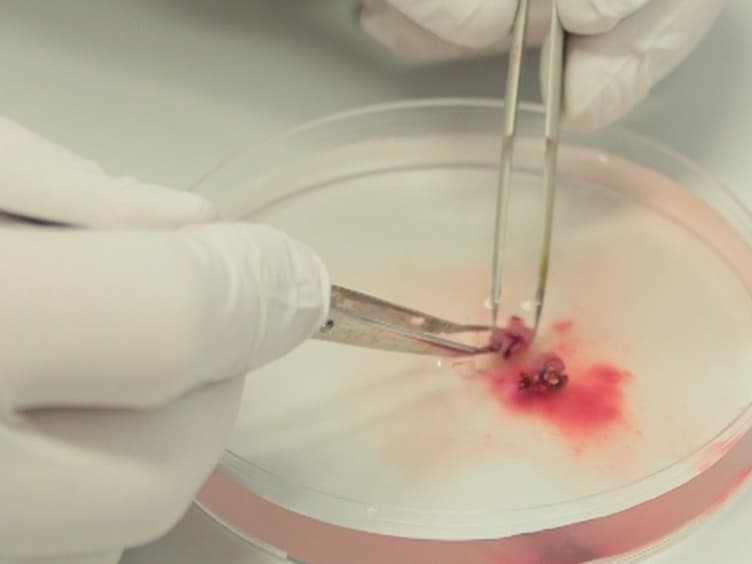 Simultaneous Assessment of Cardiomyocyte DNA Synthesis and Ploidy: A Method to Assist Quantification of Cardiomyocyte Regeneration and Turnover