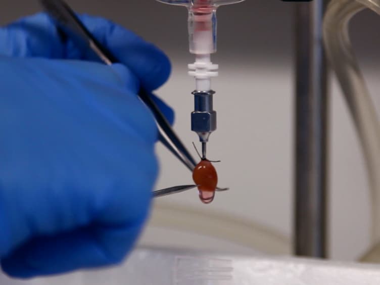 Isolation of Murine Coronary Vascular Smooth Muscle Cells