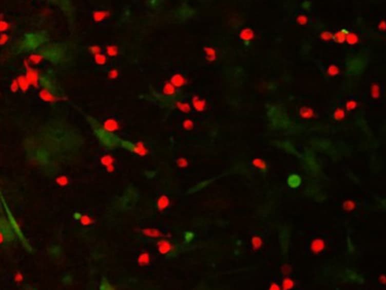 Coculture Assays to Study Macrophage and Microglia Stimulation of Glioblastoma Invasion