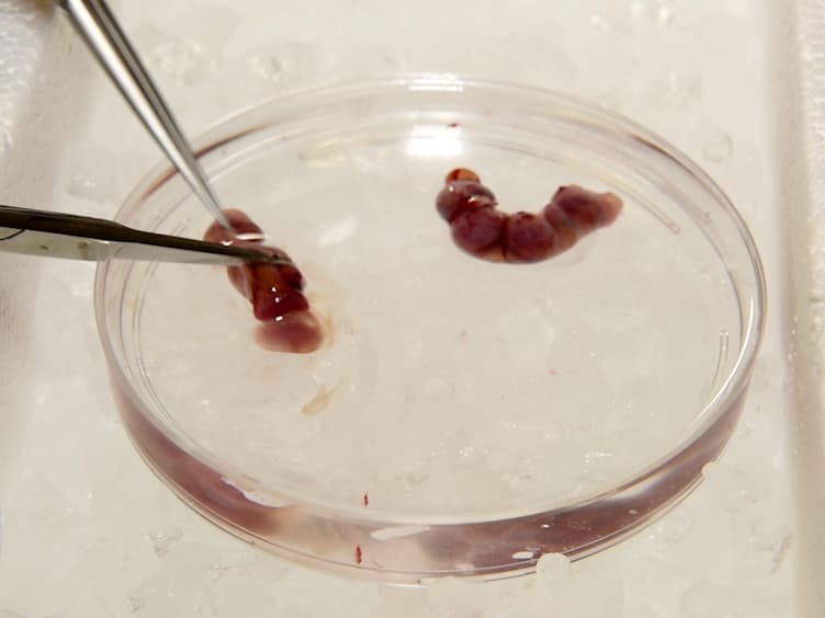 <em>In Vitro</em> Culture of Epicardial Cells From Mouse Embryonic Heart