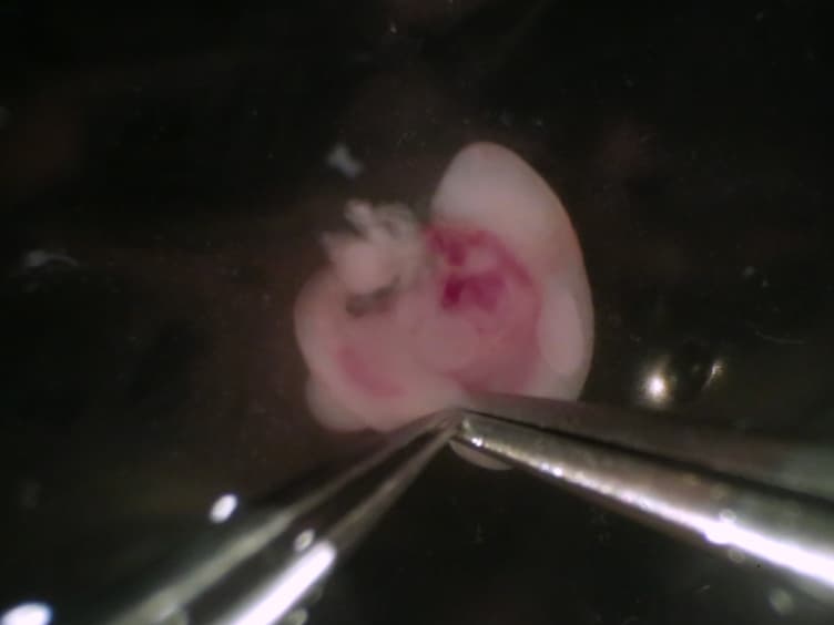 Isolation of Murine Embryonic Hemogenic Endothelial Cells