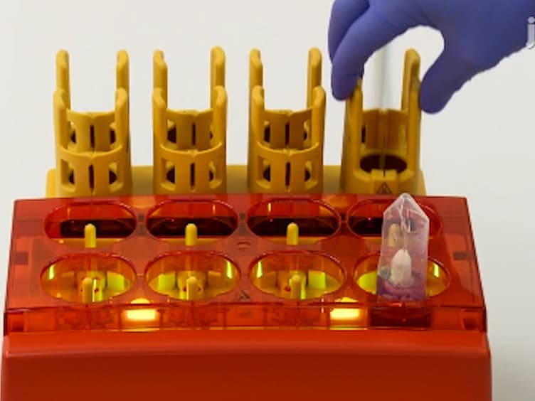 Depletion of Mouse Cells from Human Tumor Xenografts Significantly Improves Downstream Analysis of Target Cells