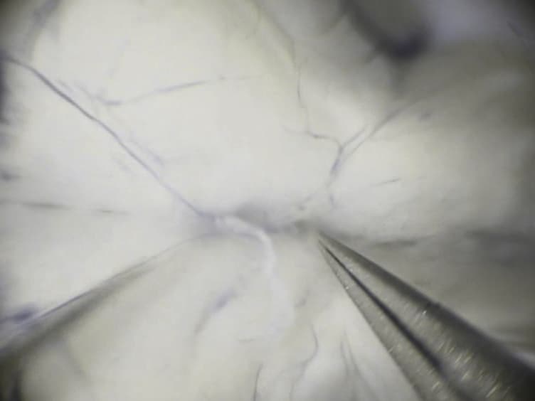 Protocol for Isolating the Mouse Circle of Willis