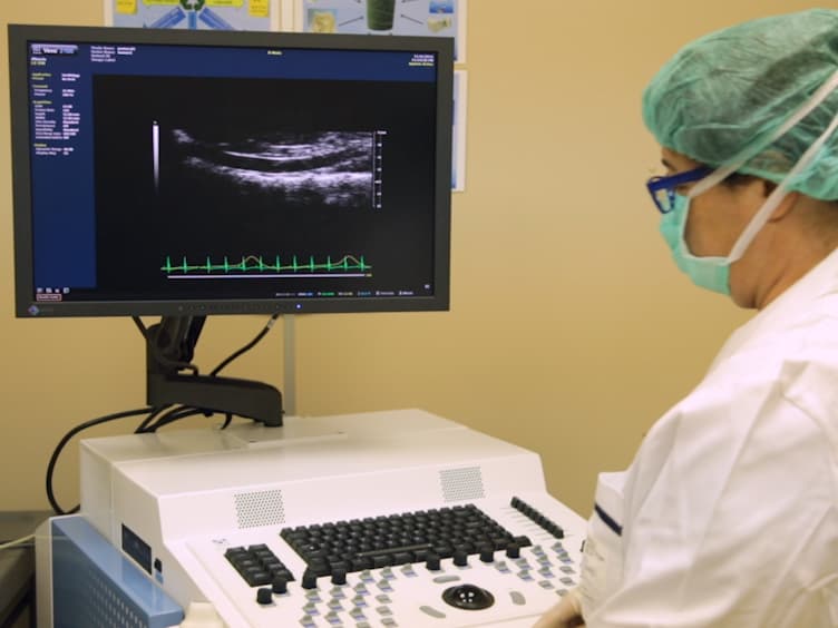 Ultrasound-based Pulse Wave Velocity Evaluation in Mice