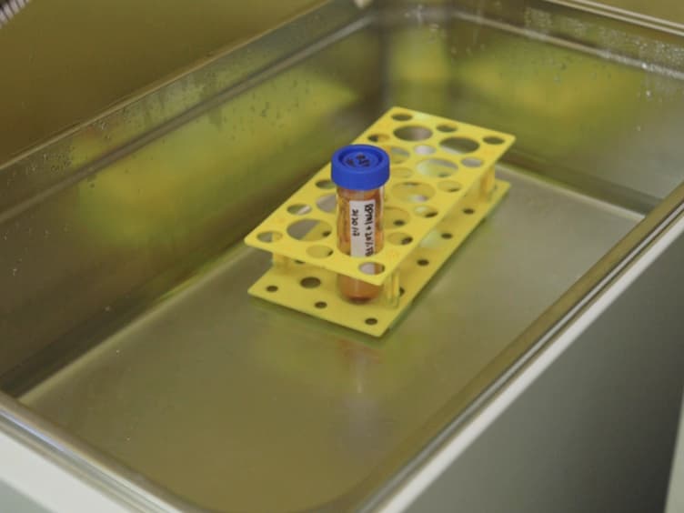 Flow-sorting and Exome Sequencing of the Reed-Sternberg Cells of Classical Hodgkin Lymphoma