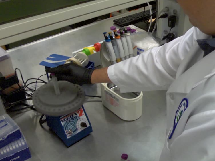 Developing a Salivary Antibody Multiplex Immunoassay to Measure Human Exposure to Environmental Pathogens